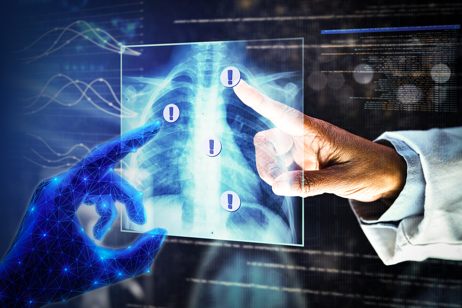 New AI Method Captures Uncertainty in Medical Images