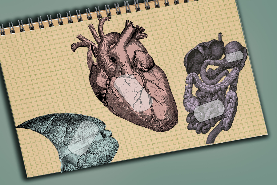 Adhesive Coatings Can Prevent Scarring Around Medical Implants