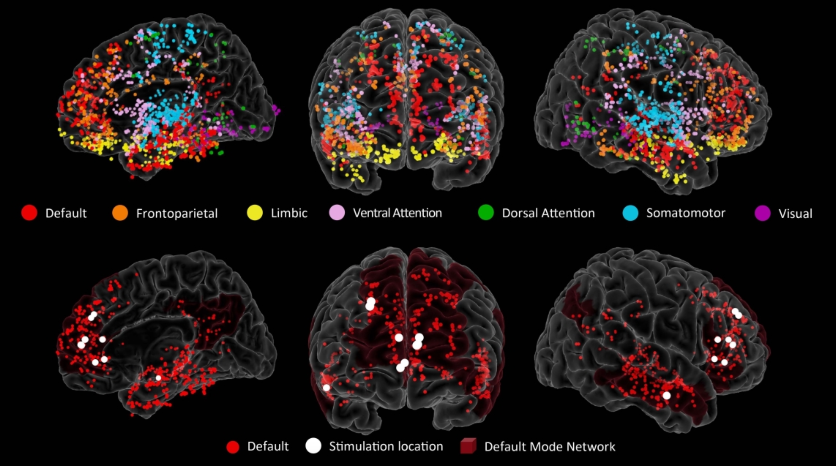 Study Pinpoints Origins of Creativity in the Brain