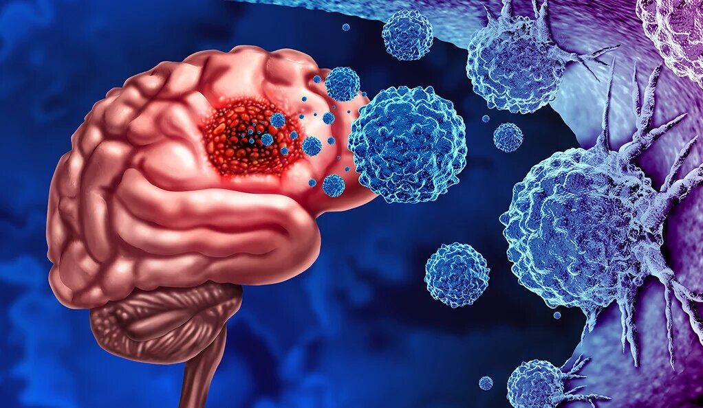 This Well-Timed ‘Chameleon’ Sneaks Up on Drug-resistant Brain Cancers