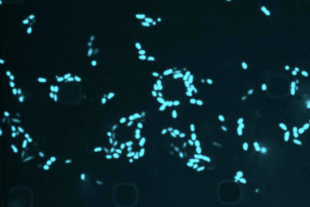 When an Antibiotic Fails: MIT Scientists Are Using AI to Target “Sleeper” Bacteria