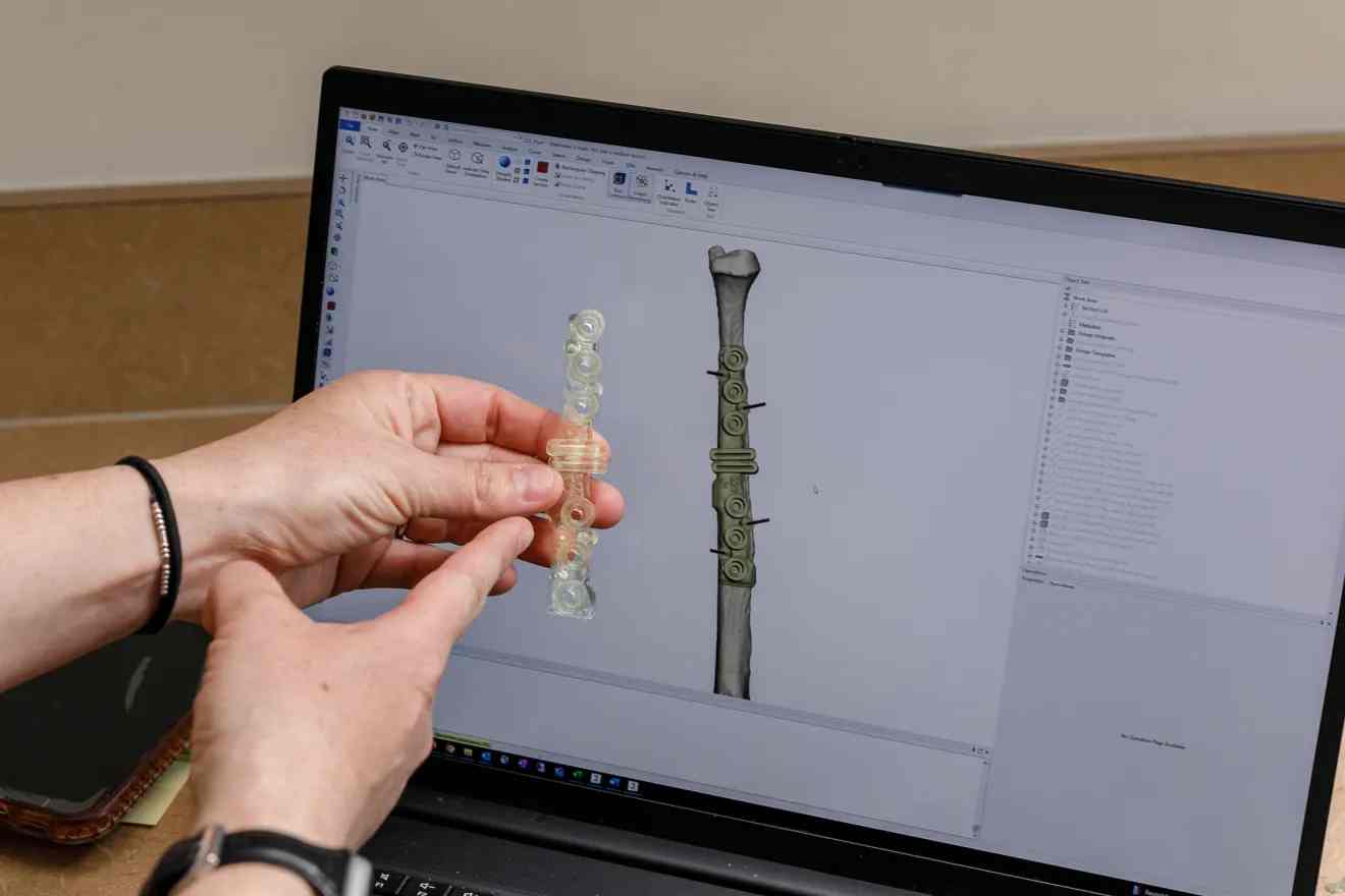 "Yale Begins 3D Orthopaedic Surgical Procedures That Are Fully In-house"