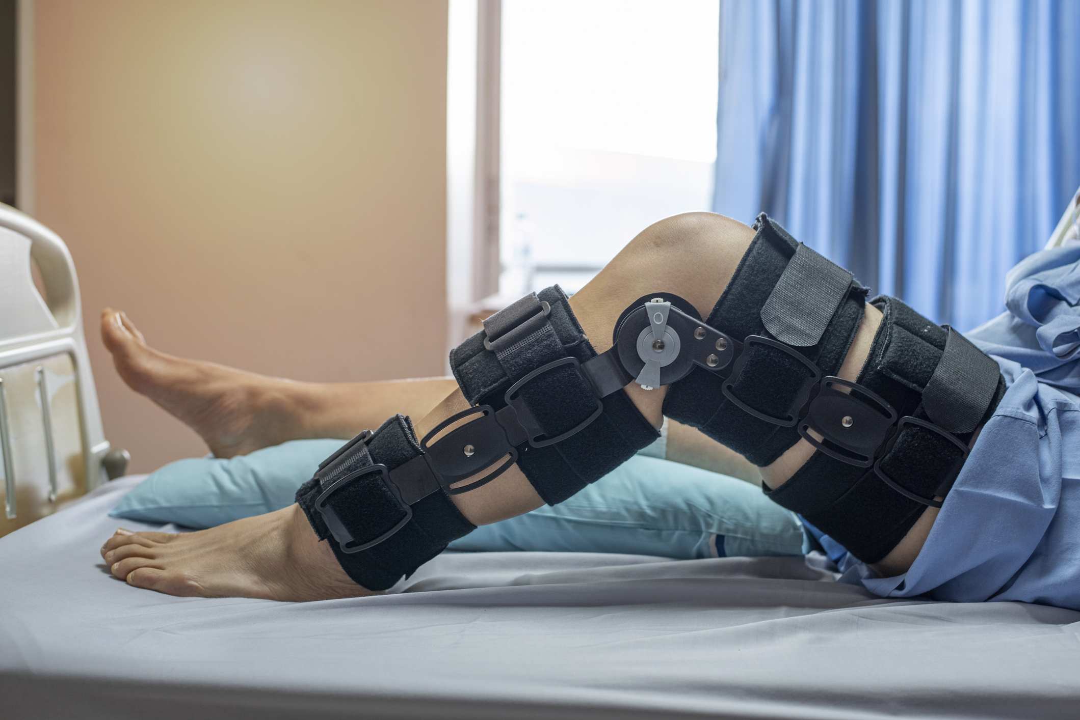 Backward Hopping May Be Better Indication of Recovery From ACL Reconstruction
