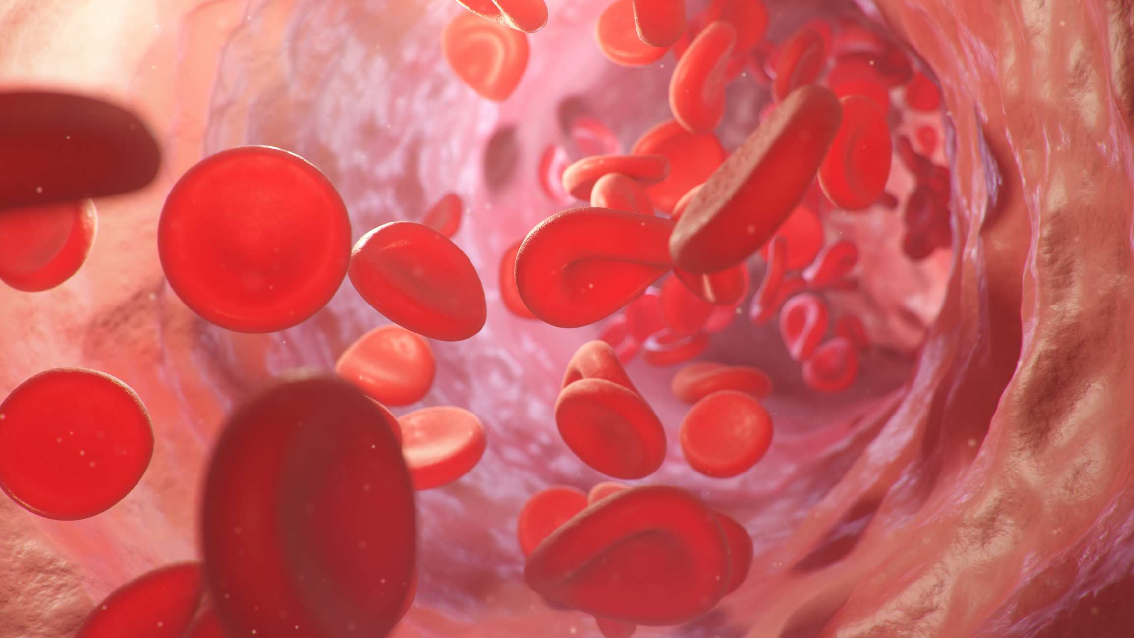 Anemia Linked to Higher Female Mortality During Heart Surgery
