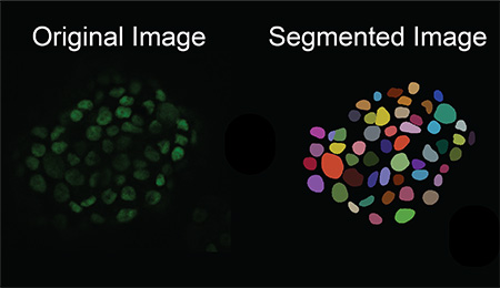 "UC Santa Cruz researchers’ tool creates ‘synthetic’ images of cells for enhanced microscopy analysis"