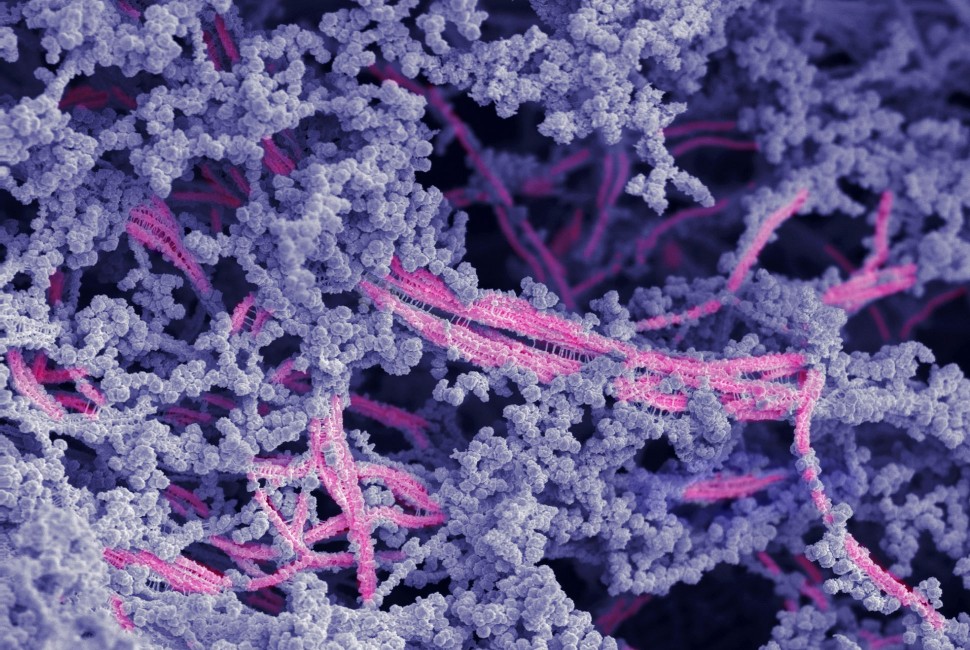 New Biomaterial Regrows Damaged Cartilage in Joints