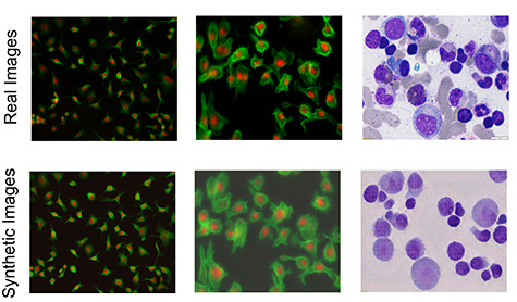 "UC Santa Cruz researchers’ tool creates ‘synthetic’ images of cells for enhanced microscopy analysis"