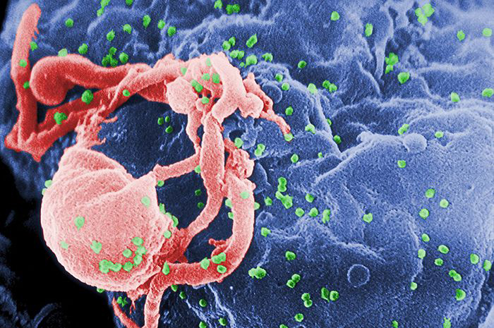 HIV-1 budding (in green) from cultured white blood cells.