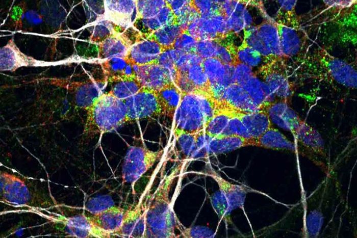 Motor nerve cell