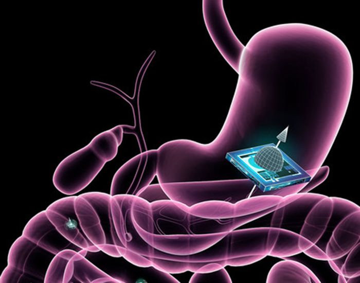 ATOMS microchip