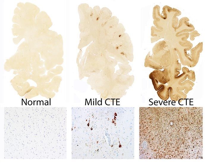 CTE-research-Figure-700x548-compressor.jpg