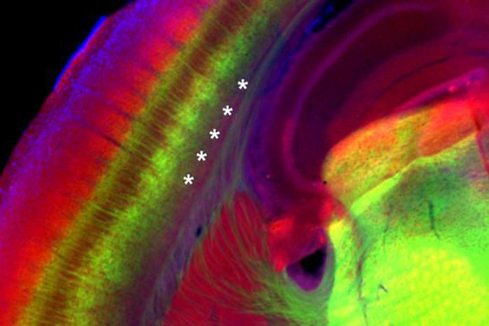 Image of mouse brain