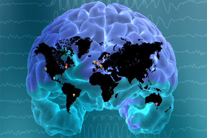 Brain image
