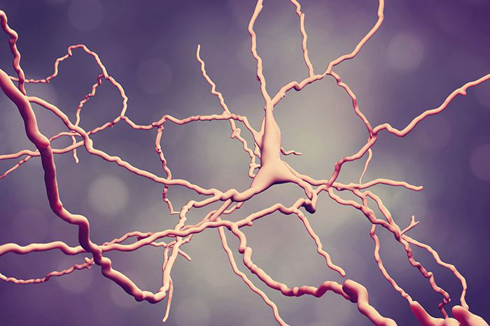 Parkinson's image