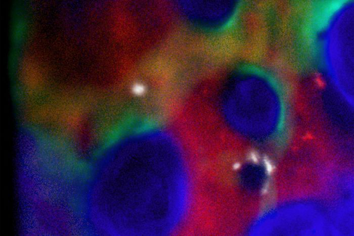 Hematopoietic_Stem_Cells_700x467-compressor.jpg