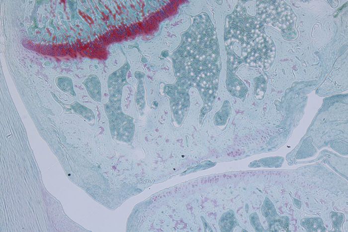 Microscopic view of joint cartilage cells.