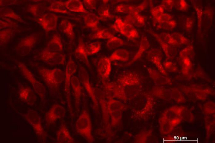 Image of lysosomes