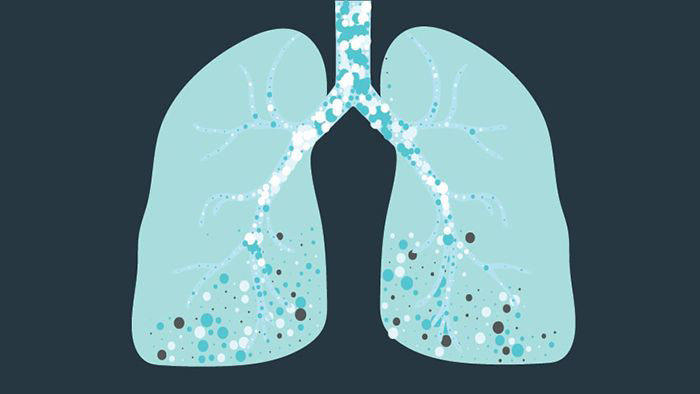 Lung illustration