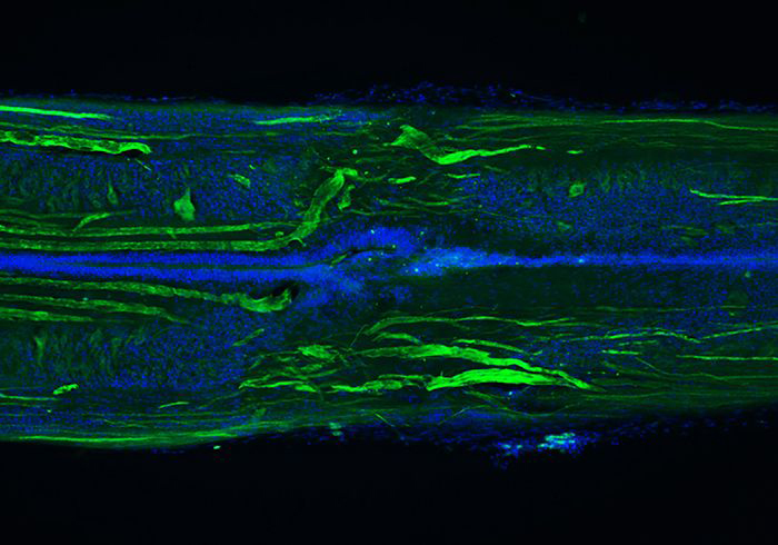 Morgan-Jennifer-RegeneratedSpinalCord-700x490-compressor.jpg