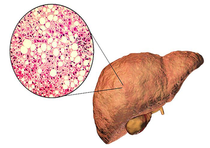 Illustration of the liver