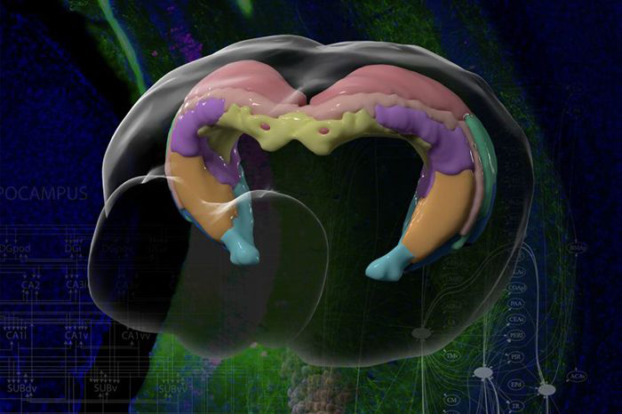 Photo: brain mapping