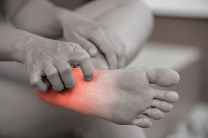 Image: neuropathic pain