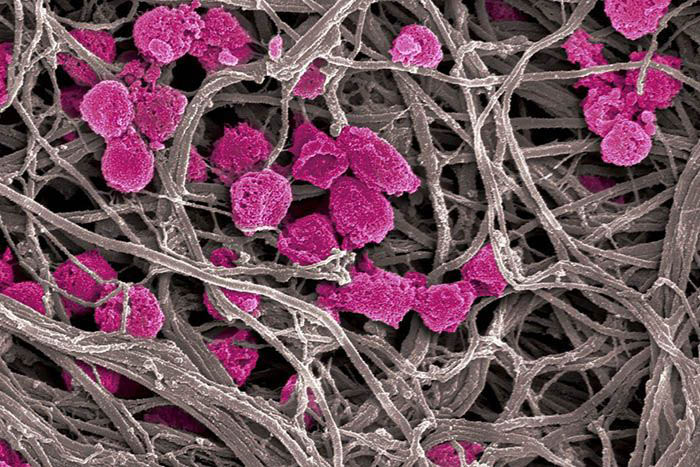 Platelet decoys, unlike normal platelets, are not activated by collagen fibers (gray), making them an attractive option for antithrombotic and cancer treatment.