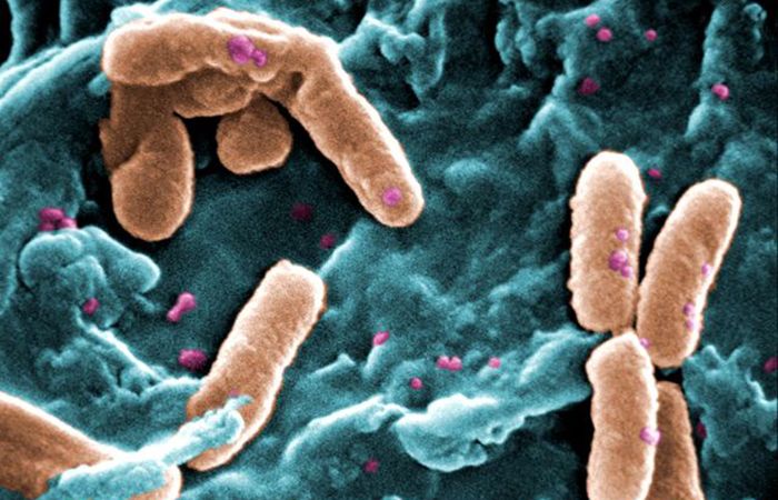 Pseudomonas aeruginosa