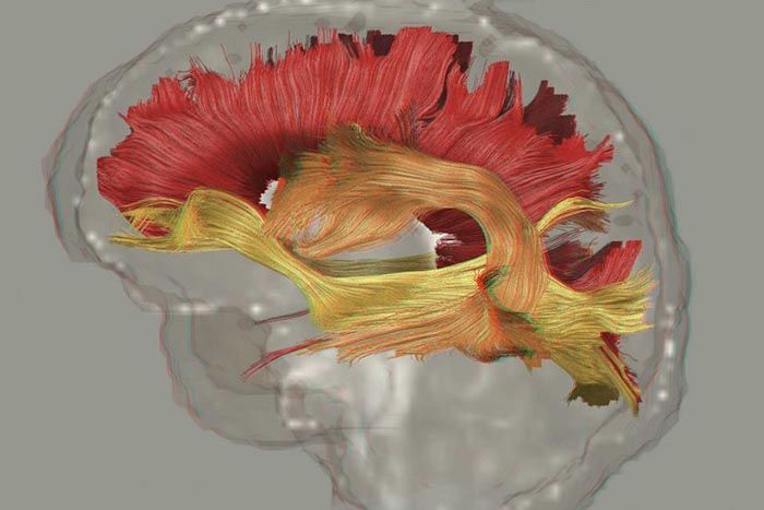 Neuro image of the brain