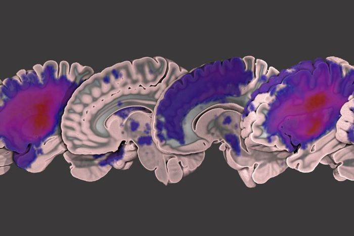 brain image