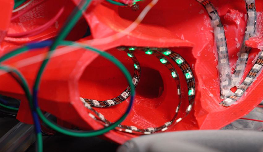wireless pacemaker array