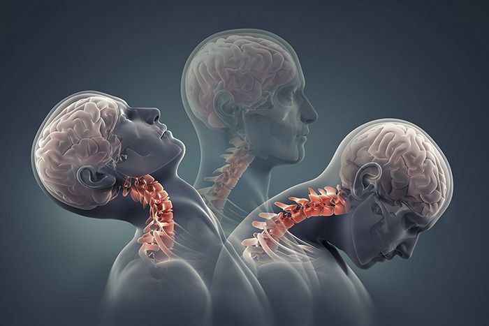 Illustration: various neck positions