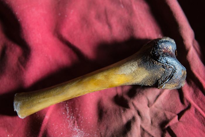 A femur bone