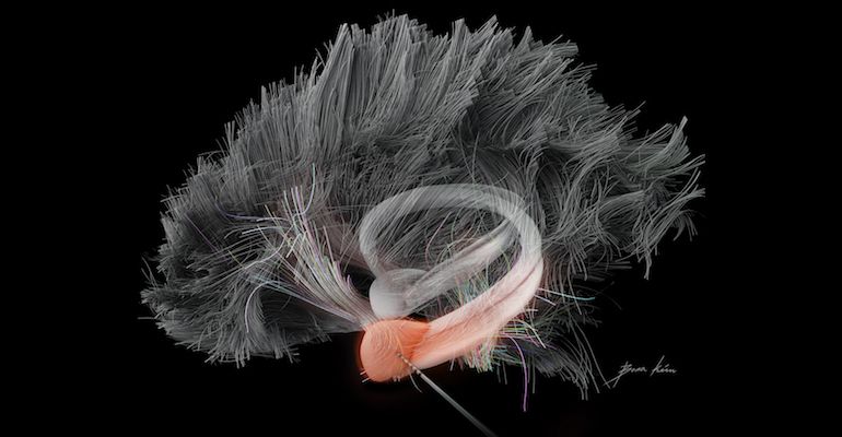 Illustration of amygdala