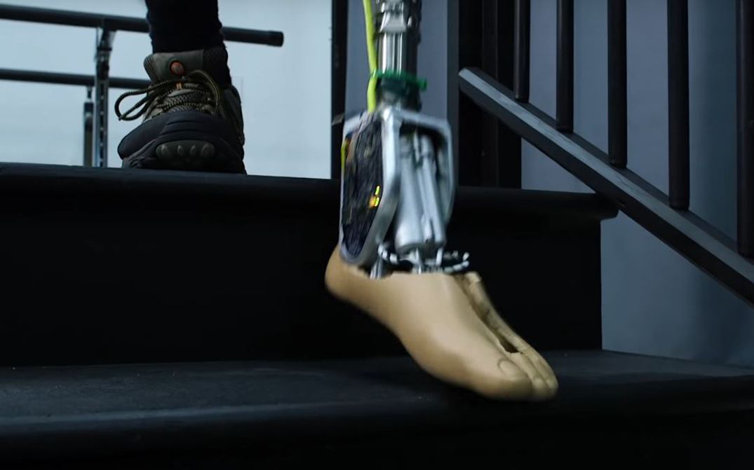 Smart prosthetic ankle takes fear out of rough terrain, stairs