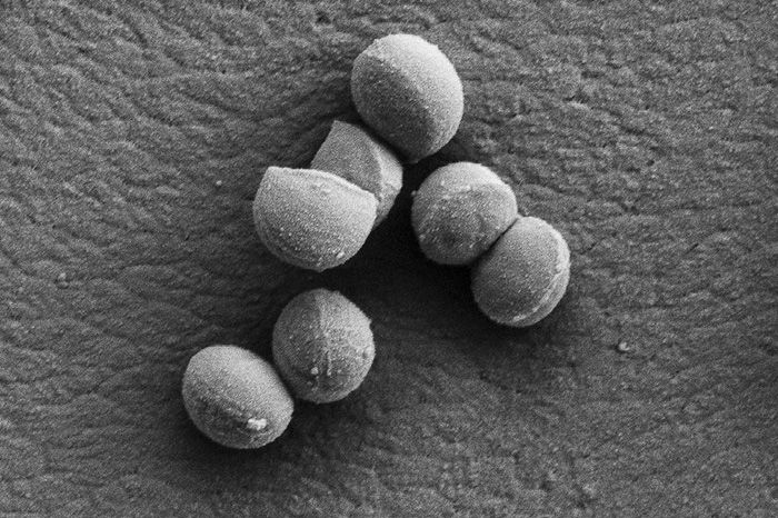 Several Staphylococcus aureus bacteria cells as they divide.
