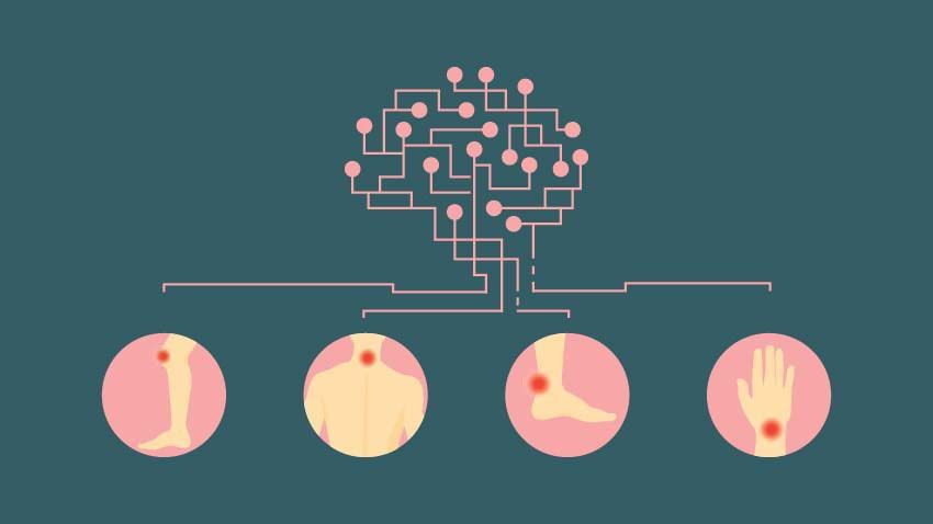 brain illustration