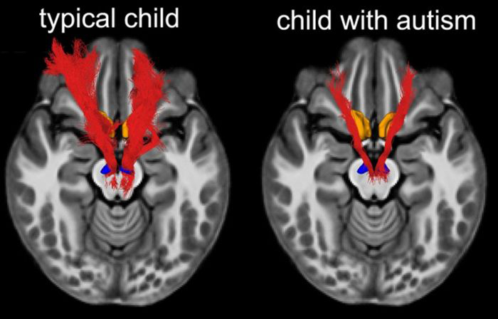 Image: MRI brain scans