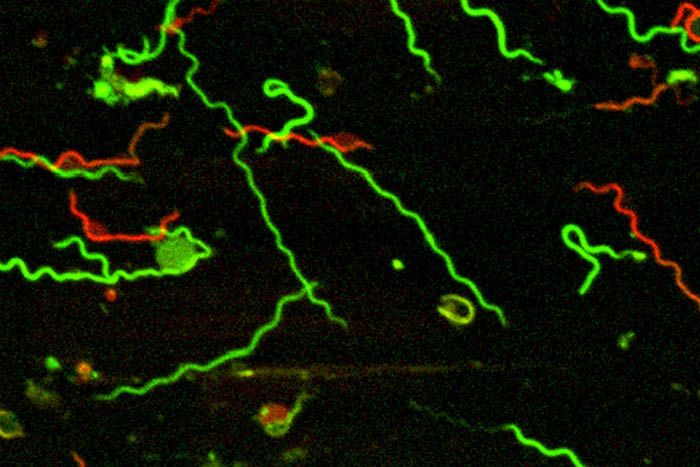 Borrelia burgdorferi, the bacteria that causes Lyme disease.