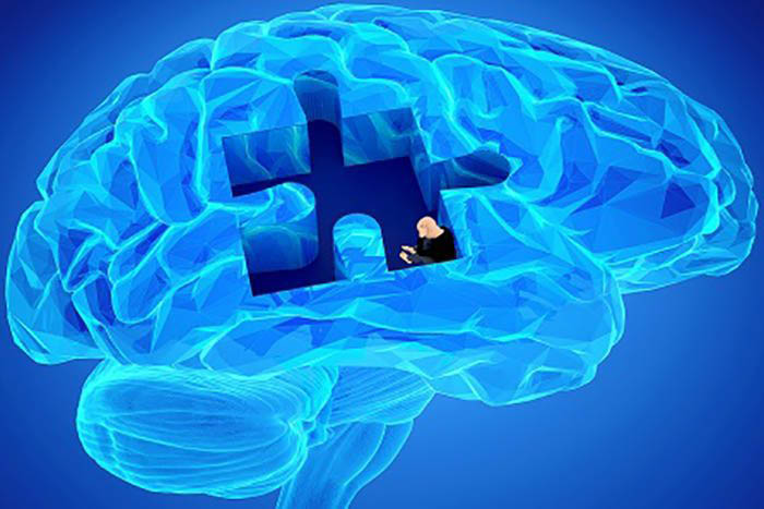 Brain illustration