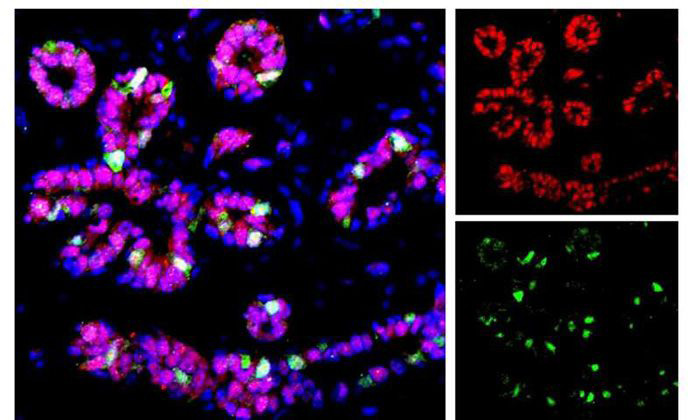 Two newly discovered luminal cell types