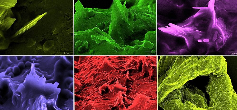 Images of cholesterol crystals