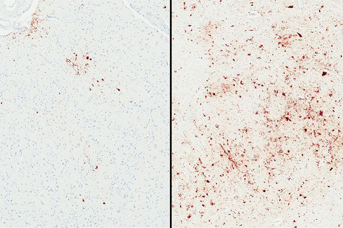 brain tissue