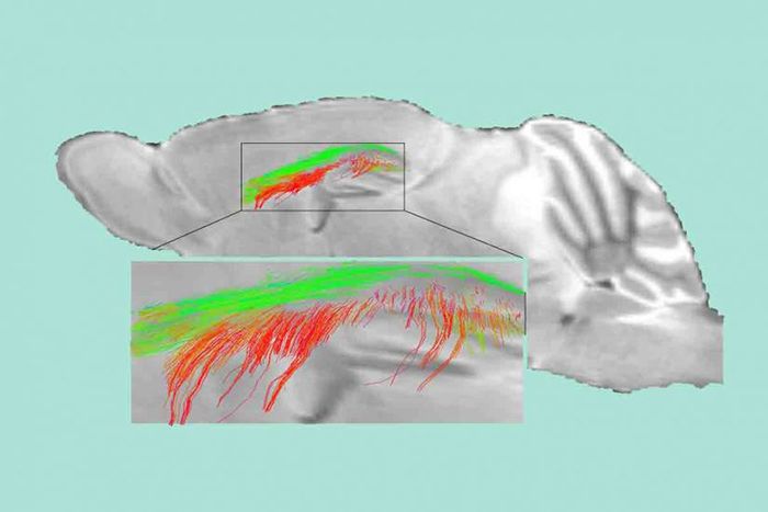 Diffusion MRI map
