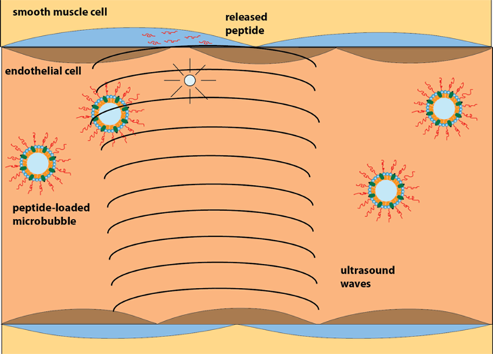 drug-delivery-system-700x467.png