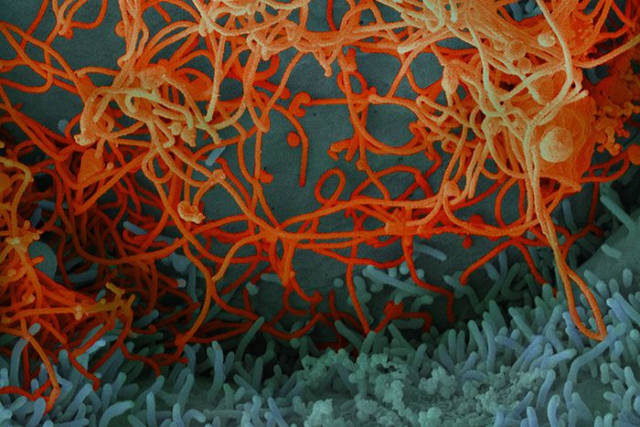 Ebola virus