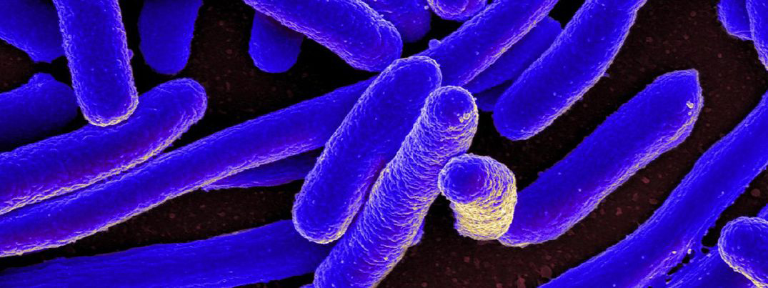 E. Coli