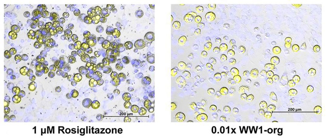 fat-cells-fracking-1075x457-compressor.jpg