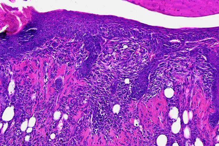 hair-follicle-regen-700x467-compressor.jpg