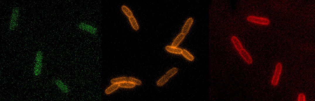 Image: The cell walls in living bacteria light up green, orange and red with three different types of RfDAA probes.
